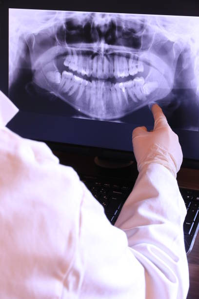 Best Emergency Dental Care for Broken or Chipped Teeth in University Park, NM